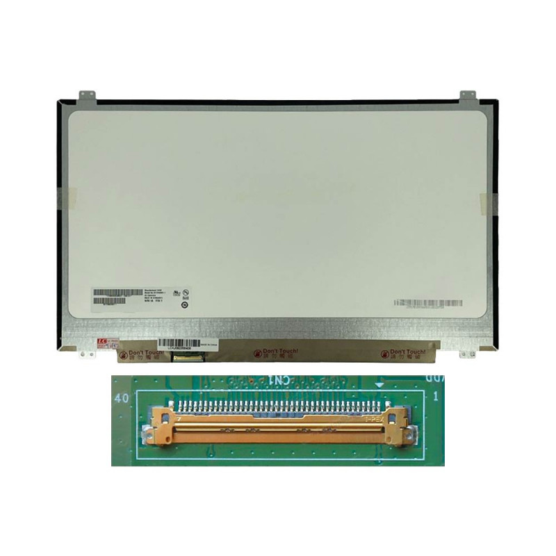 Dalle Fixations Haut Bas ~398mm - B173ZAN – PhoneFrance