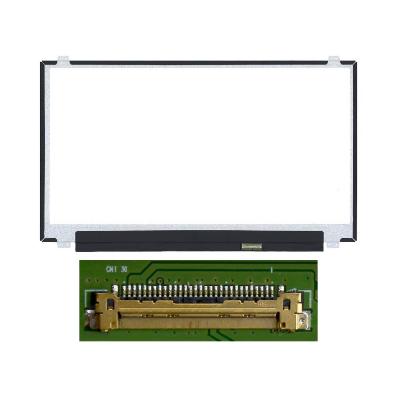 Dalle Fixations Haut Bas ~359mm - LM156LF1L03 – PhoneFrance